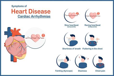 Abnormal Heartbeat: Symptoms, Causes, and Treatment.